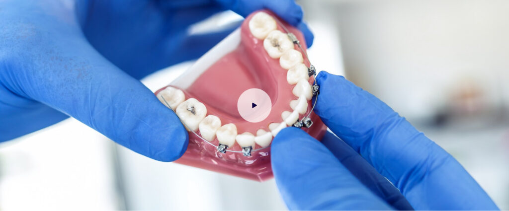 BrightBite Orthodontics Website Design & Branding | Brenham Studio